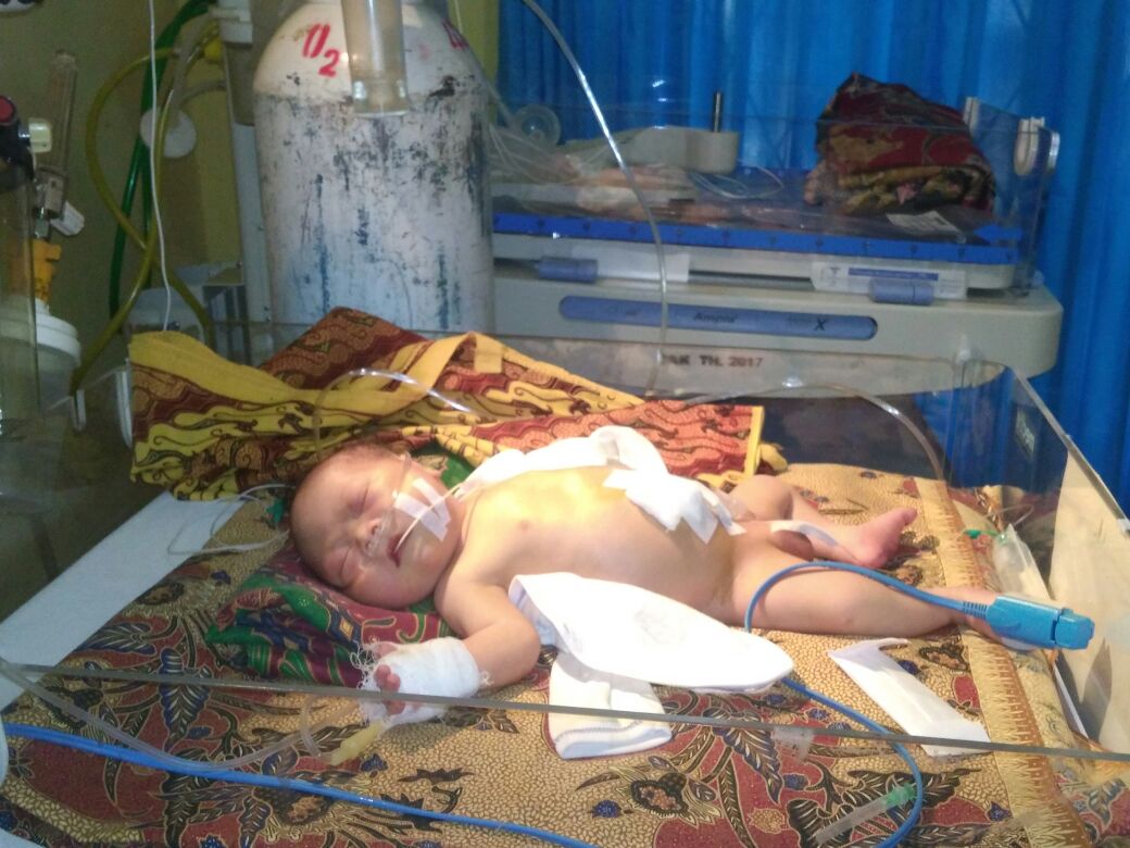 Kondisi bayi yang masih dirawat